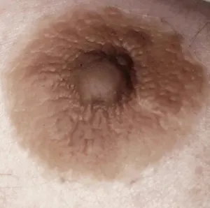 GenderMender Prosthetic Nipples for Men. Women and Non-Binary in over 100 skin-tones